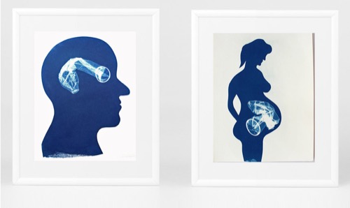 PROPHYLACTIC. Cyanotype.